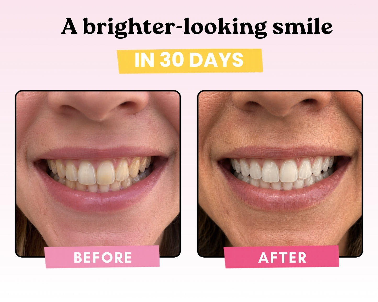 Remineralizing Gum
