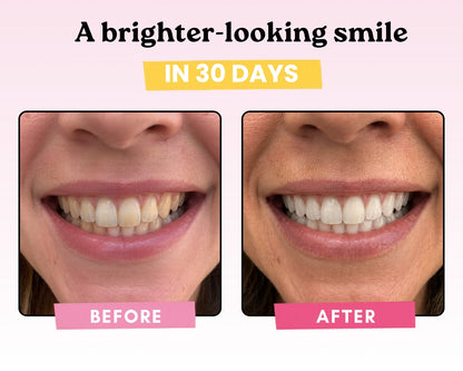 Remineralizing Gum
