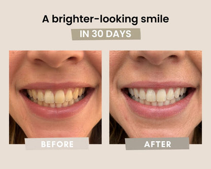 Whitening Powder with Nano-Hydroxyapatite